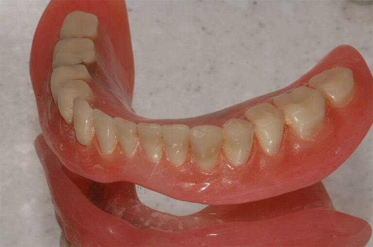 Dental prosthesis on a light gray background