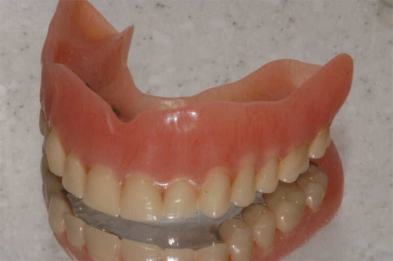 Dental prosthesis on a light gray background